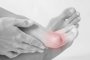 Hallux valgus  comment choisir ses chaussures