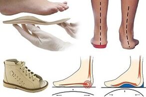 chaussures orthopédiques pour hallux valgus chez un enfant