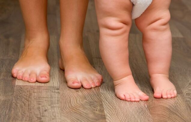 Déformation valgus du pied chez les enfants